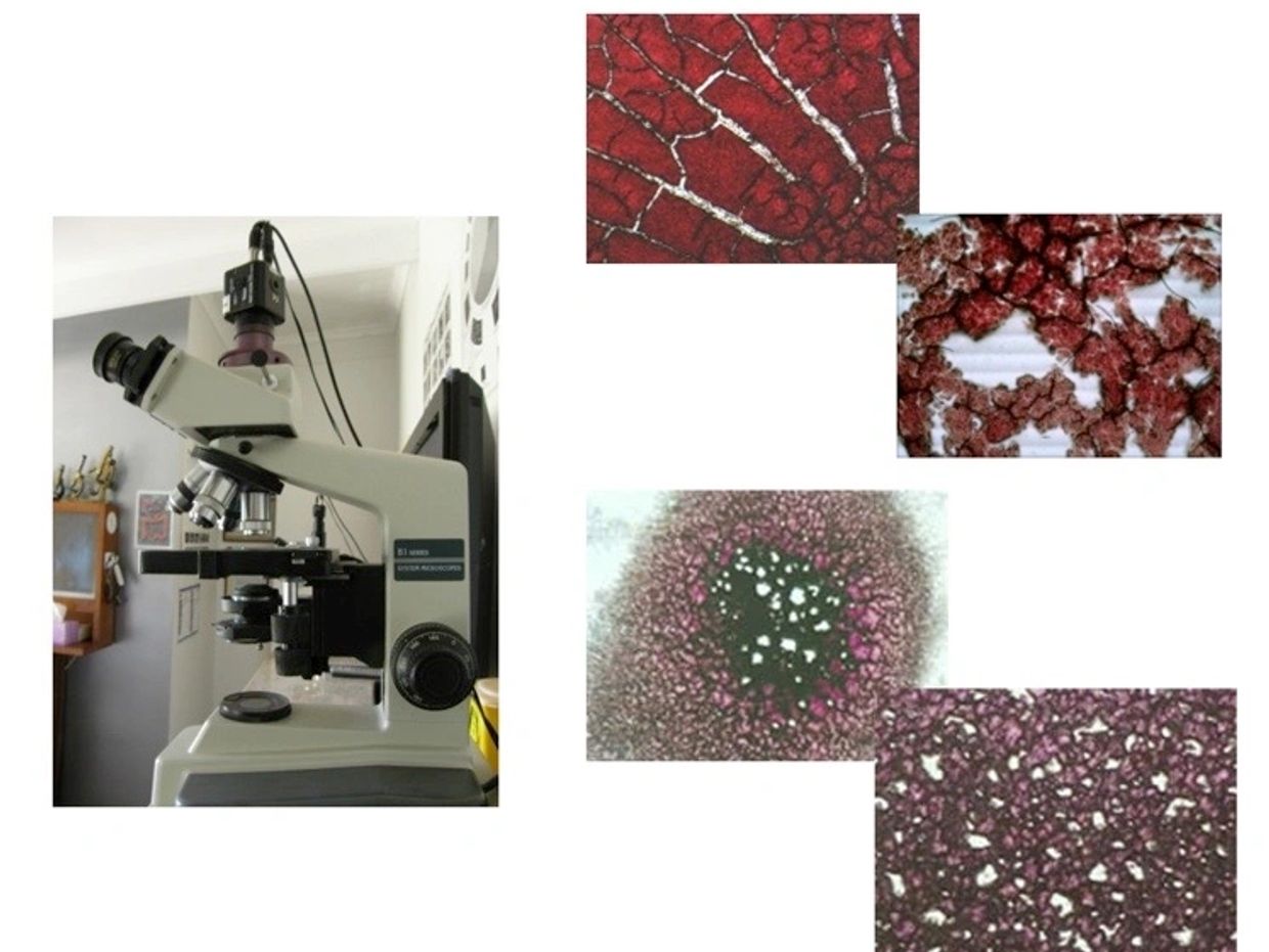 dried-blood-cell-analysis